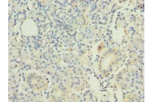 Immunohistochemistry of paraffin-embedded human pancreatic tissue using ABIN7167395 at dilution of 1:100 (RAP1A 抗体  (AA 1-181))