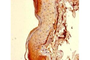 Immunohistochemistry of paraffin-embedded human skin tissue using ABIN7172166 at dilution of 1:100 (CCDC59 抗体  (AA 1-241))