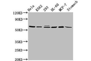 Western Blot Positive WB detected in: Hela whole cell lysate, K562 whole cell lysate, 293 whole cell lysate, HL60 whole cell lysate, MCF-7 whole cell lysate, Rat stomach tissue All lanes: GATAD2A antibody at 2. (GATAD2A 抗体  (AA 170-241))