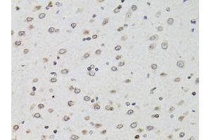 Immunohistochemistry of paraffin-embedded mouse brain using TMPO Antibody (ABIN5971365) at dilution of 1/100 (40x lens). (Thymopoietin 抗体)