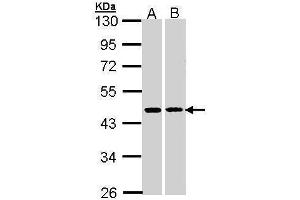 WB Image HSD3B2 antibody [N3C3] detects HSD3B2 protein by Western blot analysis. (HSD3B2 抗体)