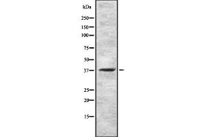Western blot analysis GNRHR using HuvEc whole cell lysates
