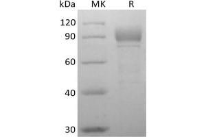 Western Blotting (WB) image for Otolin 1 (OTOL1) protein (His tag) (ABIN7319858) (Otolin 1 Protein (OTOL1) (His tag))