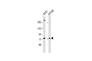 All lanes : Anti-K6 Antibody (Center) at 1:1000 dilution Lane 1: A431 whole cell lysate Lane 2: HT-29 whole cell lysate Lysates/proteins at 20 μg per lane. (PAK6 抗体  (AA 268-297))