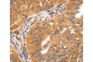 Immunohistochemistry (IHC) image for anti-Glutamate Receptor, Metabotropic 8 (GRM8) antibody (ABIN1872903) (GRM8 抗体)