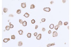 Immunocytochemistry (ICC) image for anti-Platelet Derived Growth Factor Receptor alpha (PDGFRA) (AA 24-525) antibody (ABIN7453341)