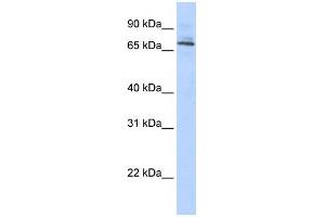 WB Suggested Anti-TRIM6 Antibody Titration:  0. (TRIM6 抗体  (Middle Region))
