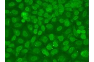 Immunofluorescence analysis of A549 cells using TARBP2 antibody. (TARBP2 抗体  (AA 1-366))
