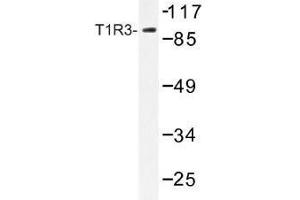 Image no. 1 for anti-Taste Receptor, Type 1, Member 3 (TAS1R3) antibody (ABIN317869) (TAS1R3 抗体)