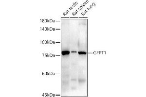 Western blot analysis of extracts of various cell lines, using GFPT1 antibody (ABIN7267430) at 1:1000 dilution. (GFPT1 抗体)