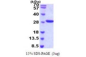 SDS-PAGE (SDS) image for Complement Factor D (CFD) (AA 21-253) protein (His tag) (ABIN5854249) (Adipsin Protein (AA 21-253) (His tag))