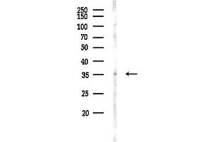 anti-Ceroid-Lipofuscinosis, Neuronal 8 (Epilepsy, Progressive with Mental Retardation) (CLN8) antibody