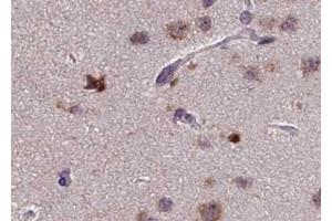 ABIN6267613 at 1/100 staining human brain tissue sections by IHC-P. (PKC zeta 抗体  (pThr410))