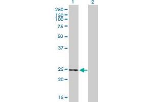 Western Blot analysis of THEM5 expression in transfected 293T cell line by THEM5 MaxPab polyclonal antibody. (THEM5 抗体  (AA 1-247))