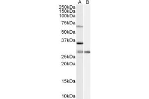 Image no. 1 for anti-Pre-mRNA Processing Factor 31 (PRPF31) (Internal Region) antibody (ABIN375228) (PRPF31 抗体  (Internal Region))