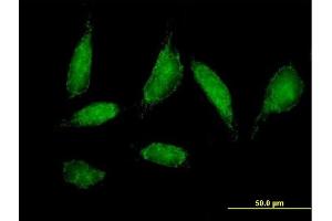 Immunofluorescence of purified MaxPab antibody to CHCHD3 on HeLa cell. (CHCHD3 抗体  (AA 1-227))