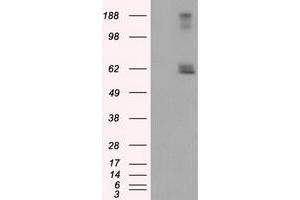 HEK293T cells were transfected with the pCMV6-ENTRY control (Left lane) or pCMV6-ENTRY LIPG (Right lane) cDNA for 48 hrs and lysed. (LIPG 抗体)