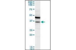 Western Blotting (WB) image for anti-Malate Dehydrogenase 2, NAD (Mitochondrial) (MDH2) antibody (ABIN953359)