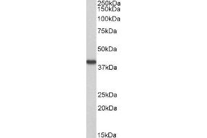 ABIN4902651 (0. (Hydroxyacid Oxidase 2 (HAO2) 抗体)