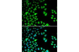 Immunofluorescence analysis of HeLa cells using RPS6KA3 antibody (ABIN5973157). (RPS6KA3 抗体)