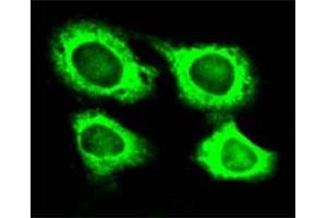 Immunofluorescence of HeLa cell line with WARS polyclonal antibody . (WARS 抗体)