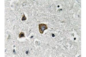 Immunohistochemistry analyzes of BNIP-3 antibody in paraffin-embedded human brain tissue. (BNIP3 抗体)