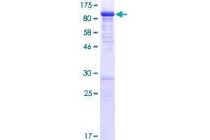 Image no. 1 for Mdm4-binding Protein (MDM4) (AA 1-490) protein (GST tag) (ABIN1310604)