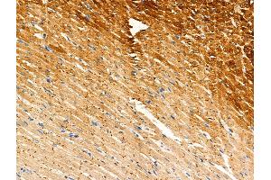 Phospho-Phospholamban (Ser714) Antibody at 1/100 staining Rat heart tissue by IHC-P.