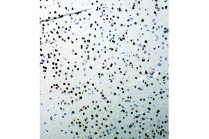 Immunohistochemistry (IHC) image for anti-Tumor Protein P53 Binding Protein 1 (TP53BP1) (AA 1955-1972), (C-Term) antibody (ABIN3044038)