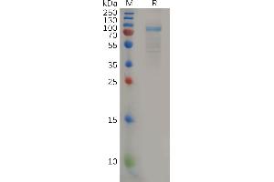 SDS-PAGE (SDS) image for Interleukin 11 Receptor, alpha (IL11RA) (AA 24-370) protein (Fc Tag) (ABIN7092738)