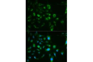Immunofluorescence analysis of MCF-7 cells using TLR8 antibody (ABIN6291882). (TLR8 抗体)