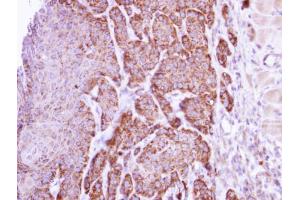 Immunohistochemistry (IHC) image for anti-Arginase, Liver (ARG1) antibody (ABIN2856661)