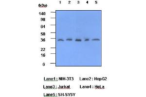 Western Blotting (WB) image for anti-C-Reactive Protein (CRP) antibody (ABIN361037) (CRP 抗体)