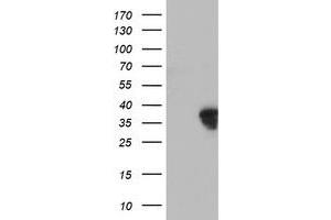 Western Blotting (WB) image for anti-Homeobox C11 (HOXC11) (AA 1-304) antibody (ABIN1490737) (HOXC11 抗体  (AA 1-304))