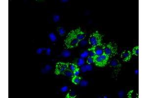 Anti-ACO2 mouse monoclonal antibody (ABIN2452697) immunofluorescent staining of COS7 cells transiently transfected by pCMV6-ENTRY ACO2 (RC204307). (ACO2 抗体)