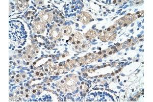 IGSF1 antibody was used for immunohistochemistry at a concentration of 4-8 ug/ml to stain Epithelial cells of renal tubule (arrows) in Human Kidney. (IGSF1 抗体  (N-Term))