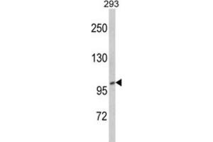Western Blotting (WB) image for anti-CTD (Carboxy-terminal Domain, RNA Polymerase II, Polypeptide A) Phosphatase, Subunit 1 (CTDP1) antibody (ABIN3002722)