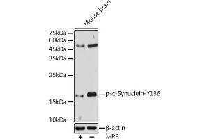 Western blot analysis of extracts of Mouse brain, using Phospho-α-Synuclein-Y136 antibody (ABIN3019943, ABIN3019944, ABIN3019945, ABIN1682064 and ABIN1682065) at 1:1000 dilution. (SNCA 抗体  (pTyr136))
