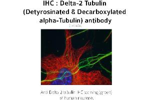 Image no. 1 for anti-Tubulin delta 2 (C-Term) antibody (ABIN489937) (Tubulin delta 2 (C-Term) 抗体)