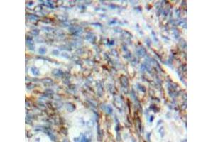 Used in DAB staining on fromalin fixed paraffin-embedded Ovary tissue