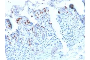 Formalin-fixed, paraffin-embedded human Small Intestine stained with CD209 Recombinant Rabbit Monoclonal Antibody (C209/2749R). (Recombinant DC-SIGN/CD209 抗体)