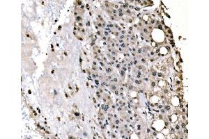 IHC analysis of splicing factor 1 using anti-splicing factor 1 antibody (ABIN7600194).