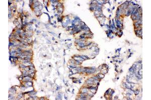 Immunohistochemistry (IHC) image for anti-Insulin-Like Growth Factor Binding Protein 3 (IGFBP3) (AA 214-252), (C-Term) antibody (ABIN3043859)