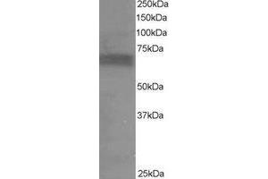 Western Blotting (WB) image for anti-Ribosomal Protein S6 Kinase, 70kDa, Polypeptide 1 (RPS6KB1) (C-Term) antibody (ABIN2465296) (RPS6KB1 抗体  (C-Term))