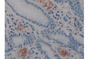 Detection of STAT2 in Human Stomach Tissue using Polyclonal Antibody to Signal Transducer And Activator Of Transcription 2 (STAT2)
