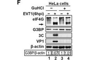 Western Blotting (WB) image for anti-Actin, beta (ACTB) antibody (ABIN3020544)