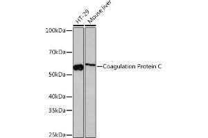Western blot analysis of extracts of various cell lines, using Coagulation Coagulation Protein C Rabbit mAb (ABIN7271333) at 1:1000 dilution. (PROC 抗体)