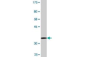 Western Blotting (WB) image for anti-Zinc Finger, MYND-Type Containing 10 (ZMYND10) (AA 341-440) antibody (ABIN526672)