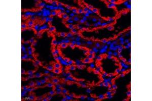 Immunofluorescence (Paraffin-embedded Sections) (IF (p)) image for anti-Aldehyde Dehydrogenase 4 Family, Member A1 (ALDH4A1) antibody (ABIN7073000)