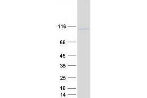 UHRF2 Protein (Myc-DYKDDDDK Tag)